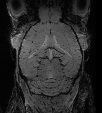 Imagerie d'un cerveau de souris © CRMSB